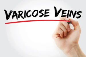 varicose vein doctor Nevada